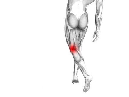 Arthrose de l'articulation du genou