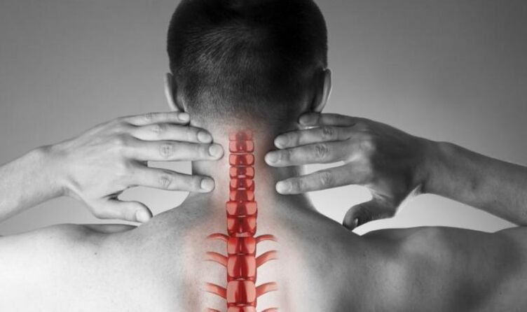 Douleur prononcée dans le syndrome neurologique