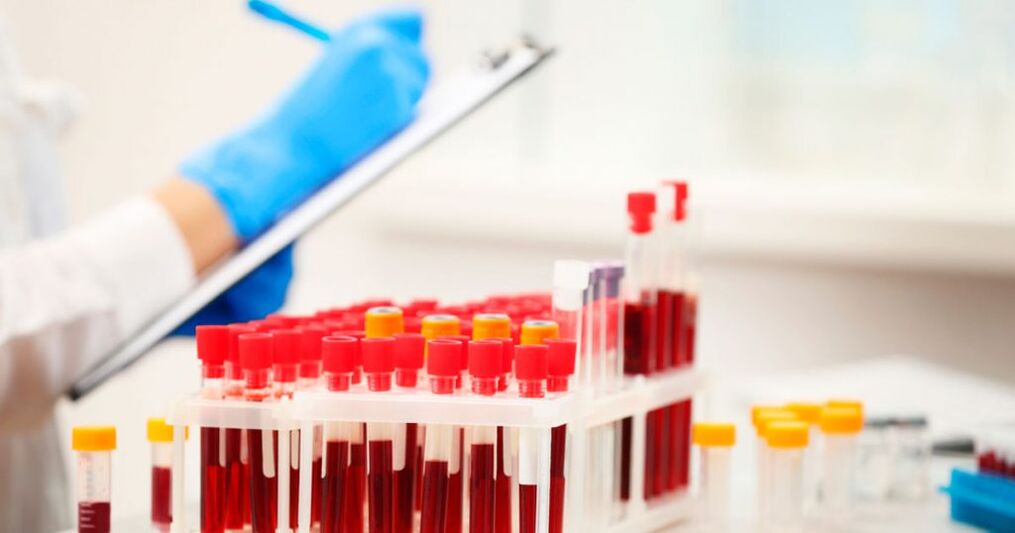 Effectuer une prise de sang pour détecter une inflammation